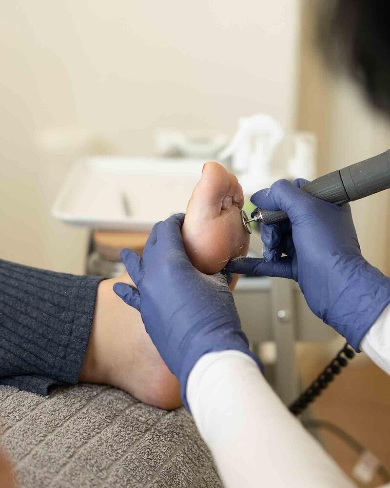 medicinski pedikir beograd